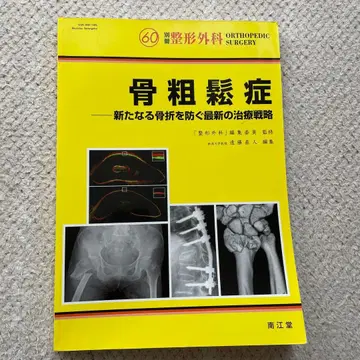 골다공증 새로운 골절을 막는 최신 치료 전략