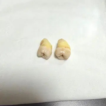 사랑니 치아 모형