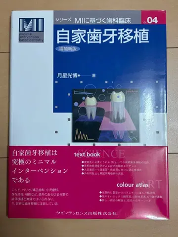 자가 치아 이식 MI 시리즈 04