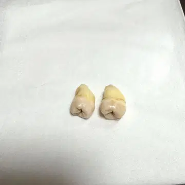 사랑니 모형 부품 치아 모양 2개 세트