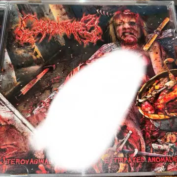 Cephalotripsy 오비 포함