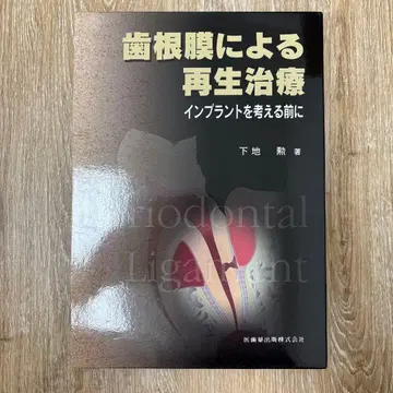 치주인대에 의한 재생 치료 : 임플란트를 생각하기 전에