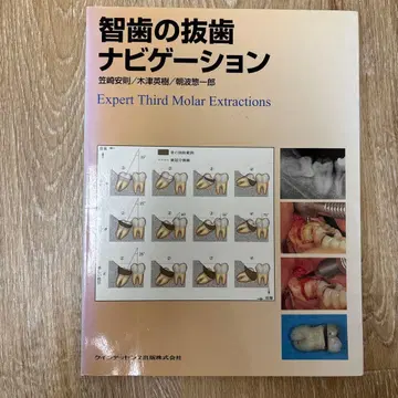 사랑니 발치 네비게이션