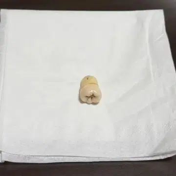 사랑니 모형 부품 치아 모형