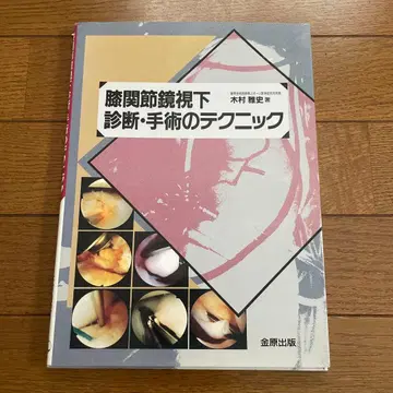 무릎 관절경 진단 수술 테크닉