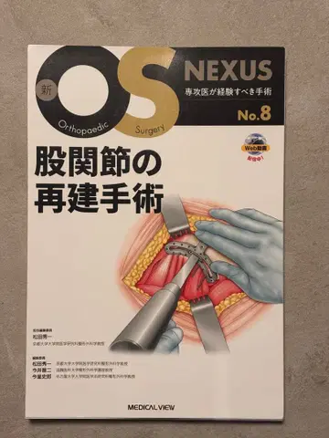 신 OS NEXUS 고관절 재건 수술