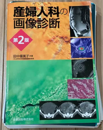 재단 완료 산부인과 이미지 진단 제2판