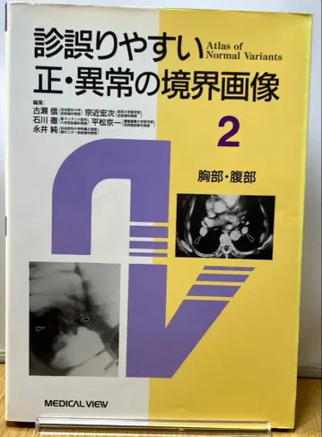 진단하기 쉬운 정상 및 이상 경계 이미지 2