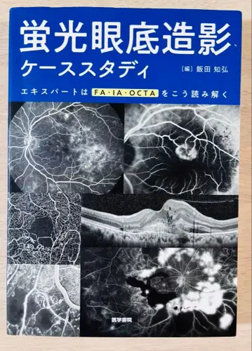 [ 기입 있음 ] 형광 안저 촬영 케이스 스터디