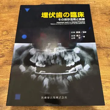 매복치의 임상: 그 보존 활용과 발치