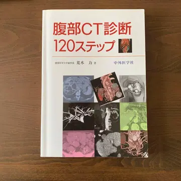 복부 CT 진단 120단계
