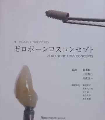 제로 본 로스 컨셉