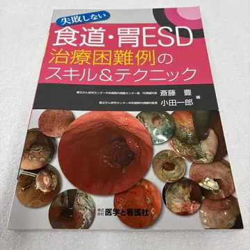 실패하지 않는 식도 위 ESD 치료 곤란 증례의 스킬 & 테크닉