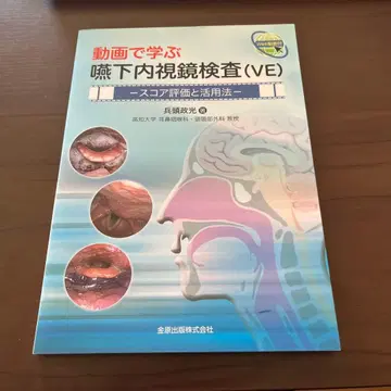 동영상으로 배우는 연하내시경 검사(VE) 점수 평가와 활용법