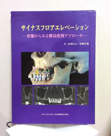 상악동저부 거상술: 형태를 통해 보는 난이도별 접근법