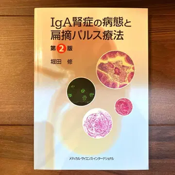 IgA 신증의 병태와 편도 적출 펄스 요법