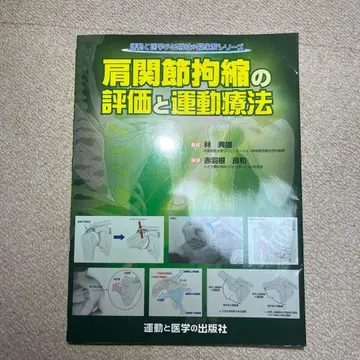 어깨 관절 구축의 평가와 운동 치료