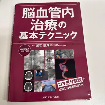 뇌혈관내 치료의 기본 테크닉 : 프레임별 해설로 지식과 기술이 연결된다