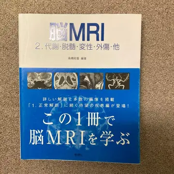 뇌 MRI 2 대사 탈수초 변성 외상 기타