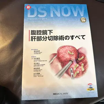 복강경 간 부분 절제의 모든 것