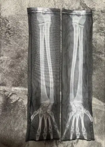 Gamchu [가무츄] [hone no 오테테다요] 렌트겐 암커버