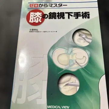 제로에서 마스터 무릎의 관절경 수술
