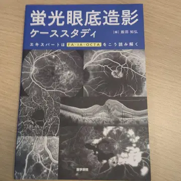 형광 안저 촬영 증례 연구
