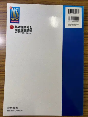 신 NS NOW3 기본 개두술과 두개저 개두술