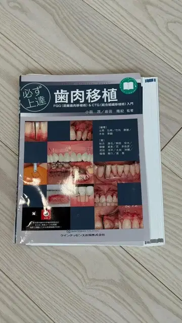 [재단 완료] 반드시 숙달 잇몸 이식 입문