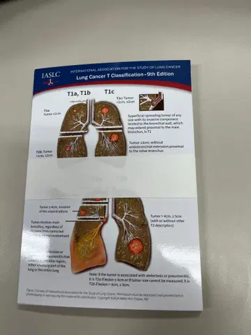 폐암 IASLC 제9판