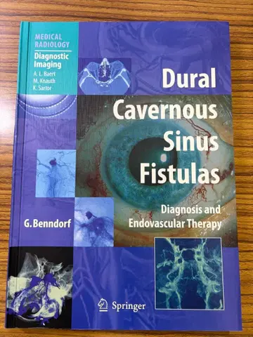 Dural Cavernous Sinus Fistulas