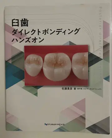 화이트 치아 다이렉트 본딩 핸즈온
