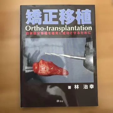 교정 이식: 자가 치아 이식을 확실하게 성공시키기 위해