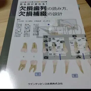 보는 눈이 달라진다! 결손치열 읽는 법