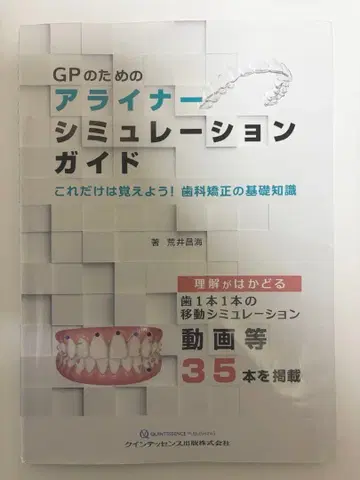 GP를 위한 얼라이너 시뮬레이션 가이드