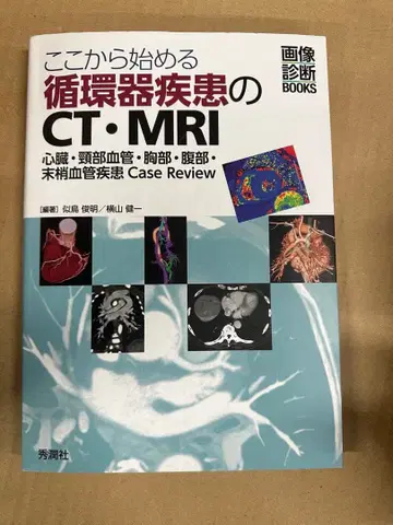여기서 시작하는 순환기 질환의 CT MRI