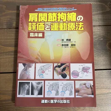 어깨 관절 구축의 평가와 운동 치료 임상편