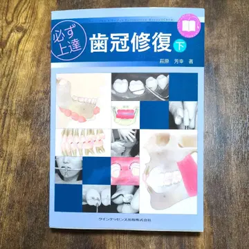 반드시 실력 향상 치관 복원 하