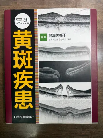 실천 황반 질환