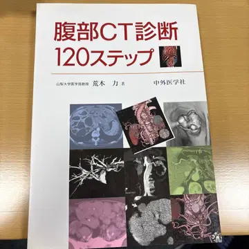 복부 CT 진단 120 단계