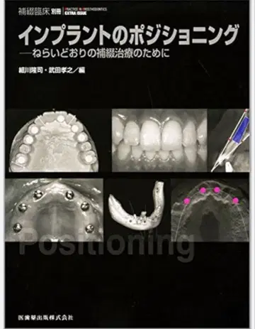 [재단 완료] 임플란트의 포지셔닝: 목표대로의 보철 치료를 위해