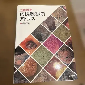 하단 소화관 내시경 진단 아틀라스