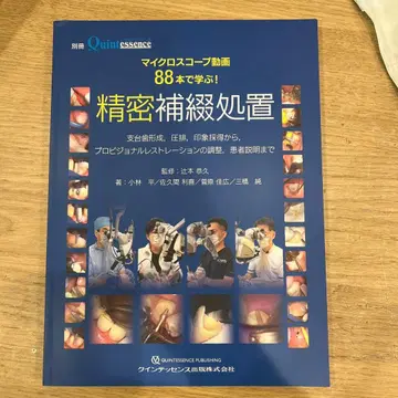 정밀 보철 시술