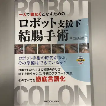 혼자서 능숙하게 해내기 위한 로봇 보조 하 대장 수술