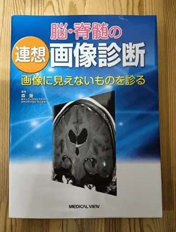 뇌 척수 연상 이미지 진단: 이미지에서 보이지 않는 것을 진단하다