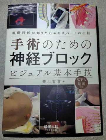 수술을 위한 신경 블록 비주얼 기본 술기