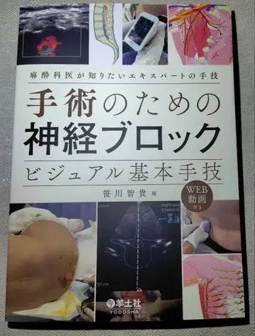 수술을 위한 신경 차단 비주얼 기본 술기