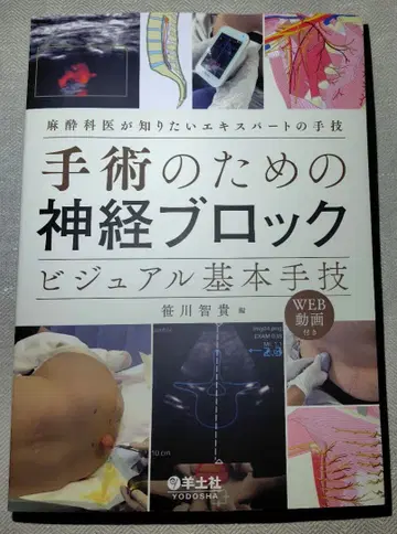 수술을 위한 신경 블록 비주얼 기본 술기