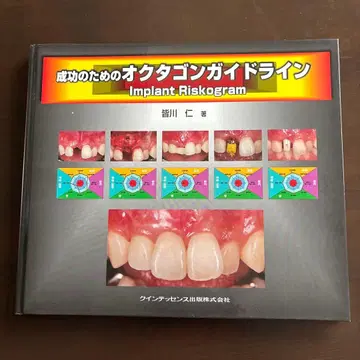 성공을 위한 옥타곤 가이드라인 Implant Riskogram