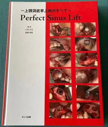 Perfect Sinus Lift - 상악동저 거상술의 모든 것